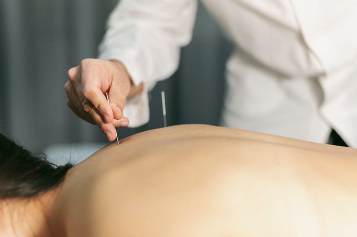 Agulhamento a seco (Dry Needling)